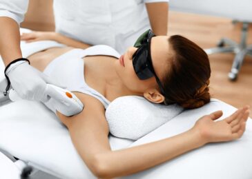 Tout savoir sur l’épilation au laser : avantages, coûts et précautions